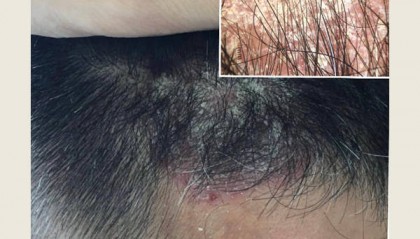 去屑止痒比较好的男士洗发水?比较好的洗发水