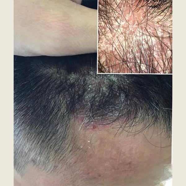 去屑止痒比较好的男士洗发水?比较好的洗发水